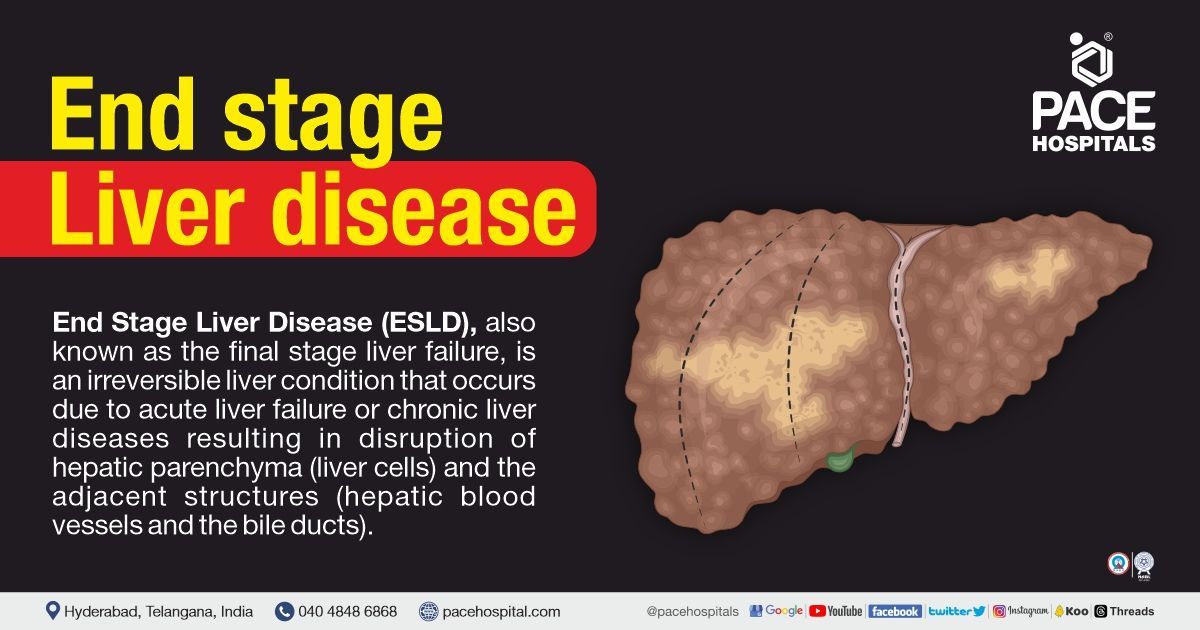 End Stage Liver Disease Symptoms Causes Complications